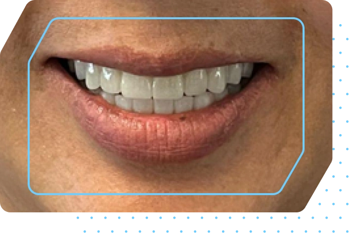implant-image